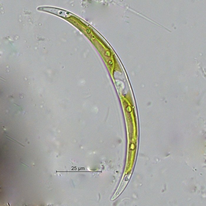 Closterium cf.parvulum.jpg