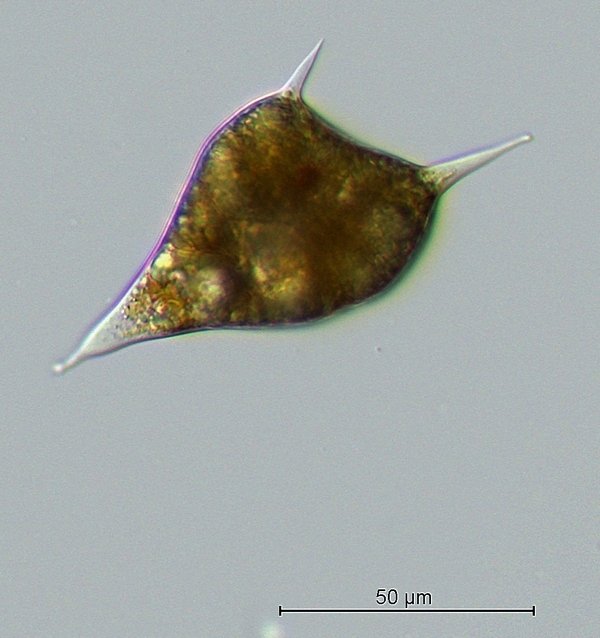 Zyste von Ceratium hirundinella.jpg