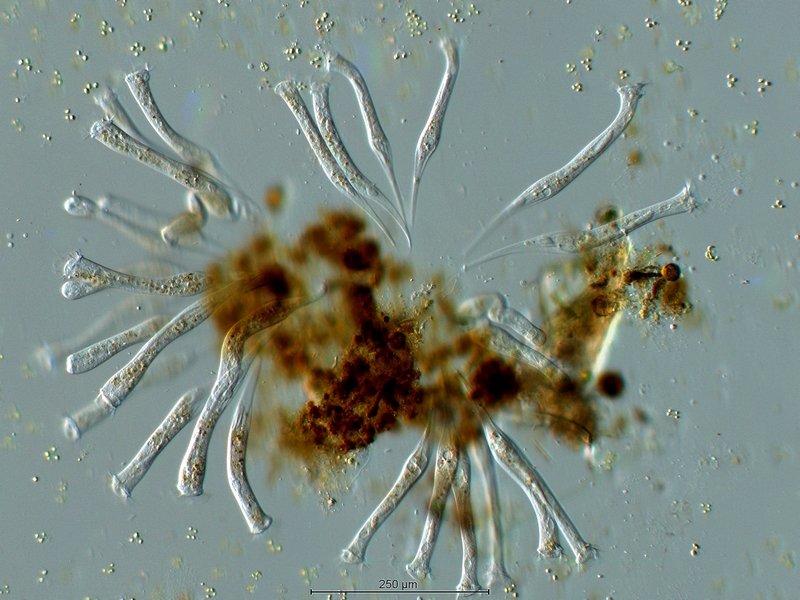 Ophrydium spec._ Gerda spec._10x.jpg