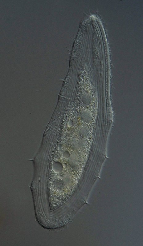 Auf diesem Bild sieht man die Dornen nur ansatzweise, dafür gut den perlschnurartigen Makronukleus. Wahrscheinlich sind es nur 6 Elemente, aber beim vierten von Oben sieht es aus wie zwei Kerne, dann wären es 7, und einer mehr als bei Kahl angegeben.