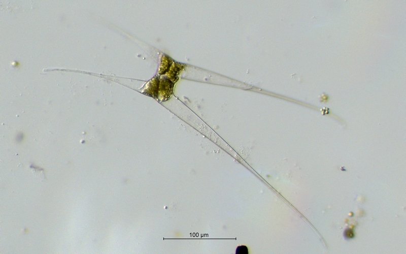 Zygote_Closterium kuetzingii_20x.jpg