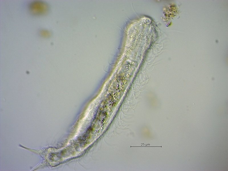 Chaetonotus spec._1.jpg