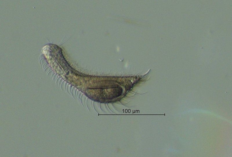 Chaetonotus spec._2.jpg