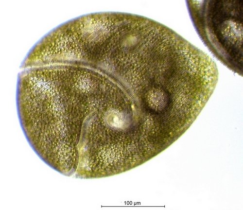 Stentor amethystinus_1.jpg