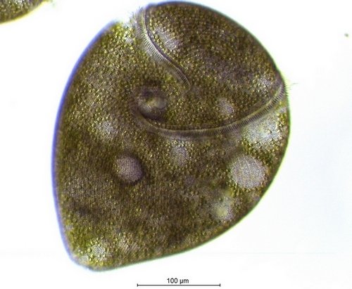 Stentor amethystinus_2.jpg