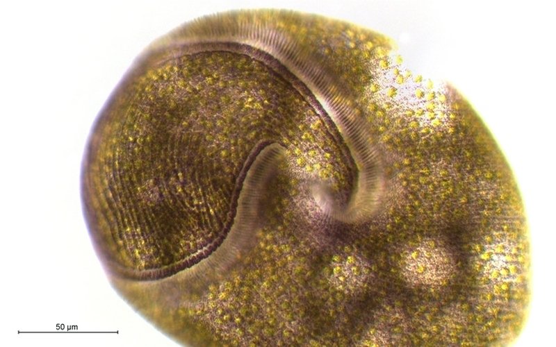 Stentor amethystinus_4.jpg