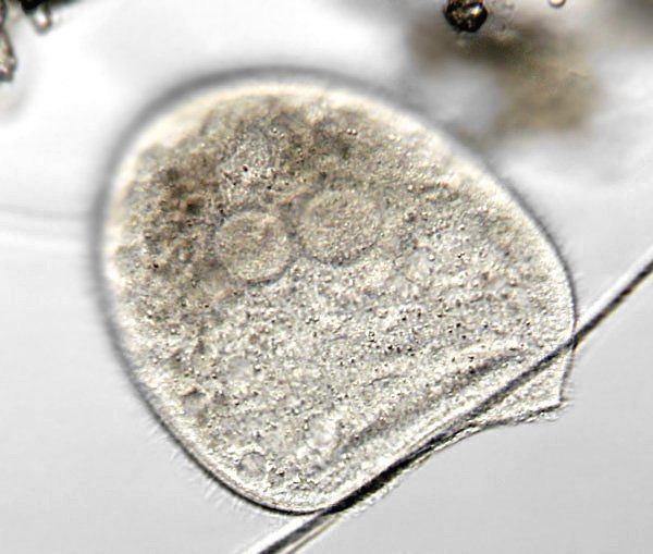 ciliat.p2a.jpg