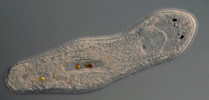 Diese Planarie hat ein paar Kieselalgen gefressen, die man noch sehr gut erkennen kann.