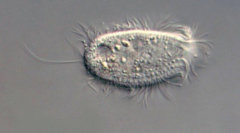 Hier sieht man die lange Cilie am Hinterende, die die möglichen Arten schon mal erheblich einschränkt. Ich bin nicht ganz sicher, aber das obens rechts am Rand könnten Trichocysten sein.