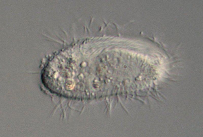 Oben sieht mal vermutlich die undulierende Membran, die sich hier als aufgelöst in Cilien darstellt.