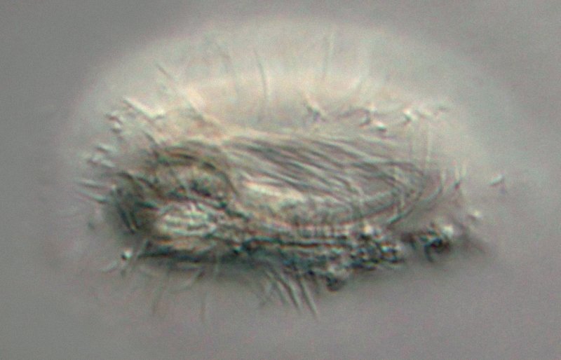 Und hier noch einmal das komplette Gewusel der Wimpern.