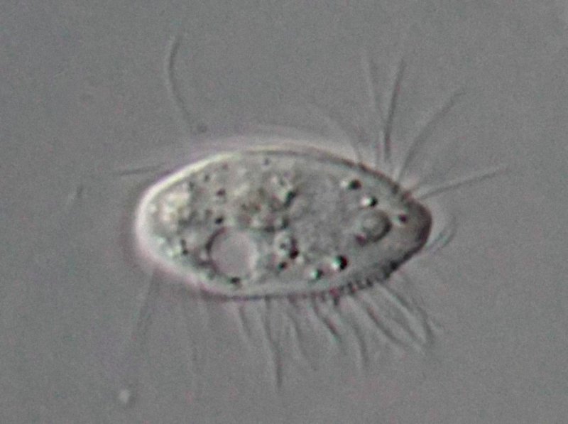 Das ist das Exemplar, das ich über einen Monat früher in der Probe gesehen hatte, vermutlich dieselbe Art, aber diesmal sieht man die wimperlose Kopfplatte. Vermutlich hatte ich das Tier von der Dorsalseite unter dem Mikroskop.