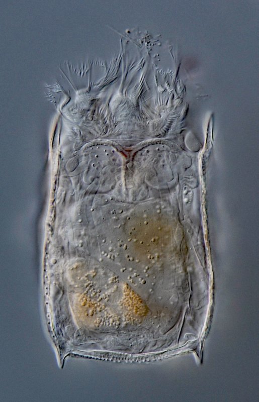 Hier sind die drei Loben des Räderorgans gut zu erkennen, und auch ein kleiner Nebenlobus am linken Laterallobus.