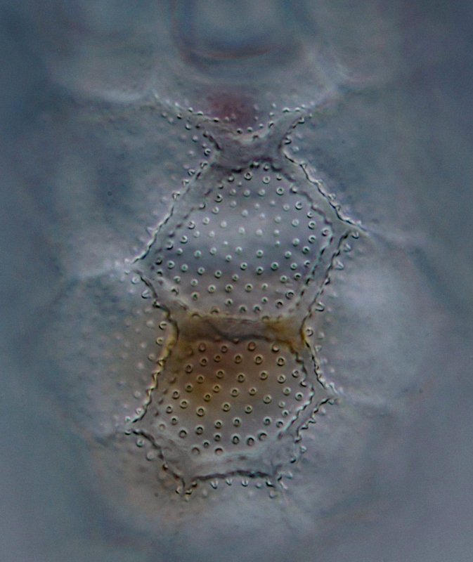 Der Dorsalpanzer hat eine intderessante Facettenstruktur, und auch eine sehr schöne Körnelung.