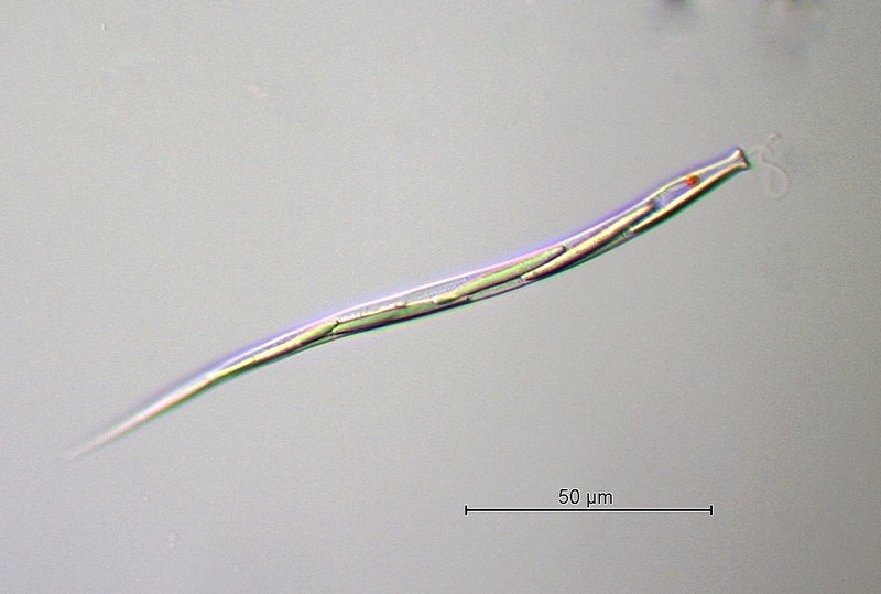 Cyclidiopsis acus.jpg