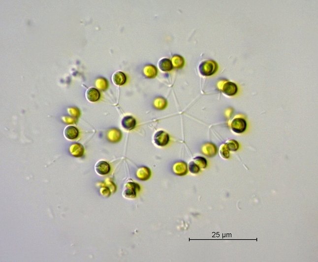 Dictyosphaerium ehrenbergianum.jpg