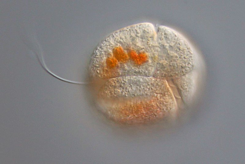 40 µm. Und noch ein Dinoflagellat. Man sieht die zwei Flagellen