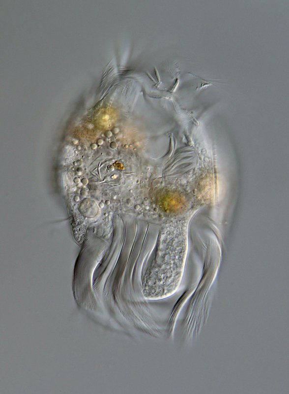 64 µm. Und hier mein Lieblingstierchen, dass ich schon beim letzten Mal gefunden hatte: Uronychia transfuga.