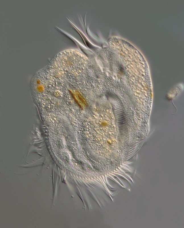 70 µm. Bisschen wie Uronychia, aber vermutlich eine andere Art.