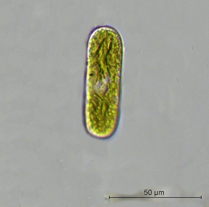 Cylindrocystis cf. gracilis.jpg