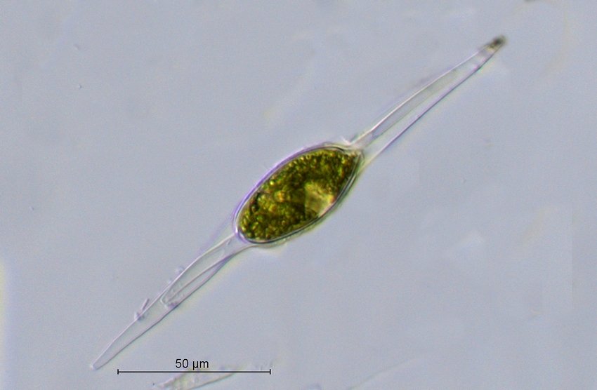 Zygote_Closterium idiosporum var. idiosporum.jpg