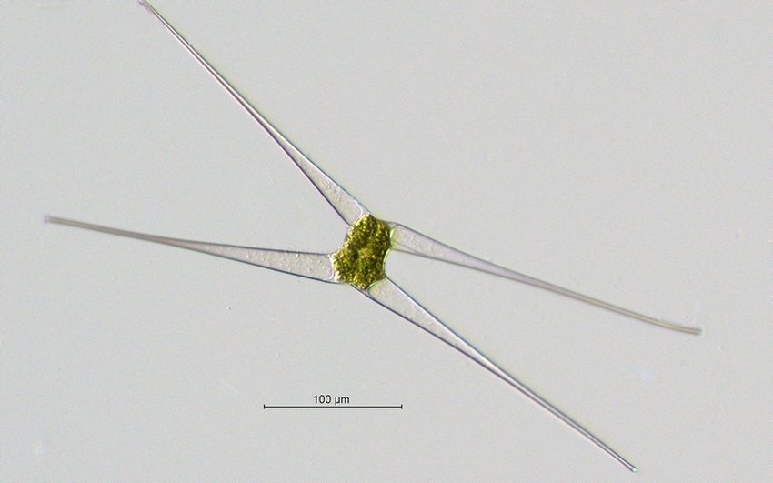 Zygote_Closterium kuetzingii_20x.jpg