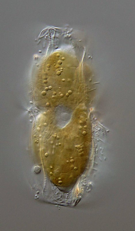 Hier sieht man die zwei Chlorplasten und die krusselige Schale.