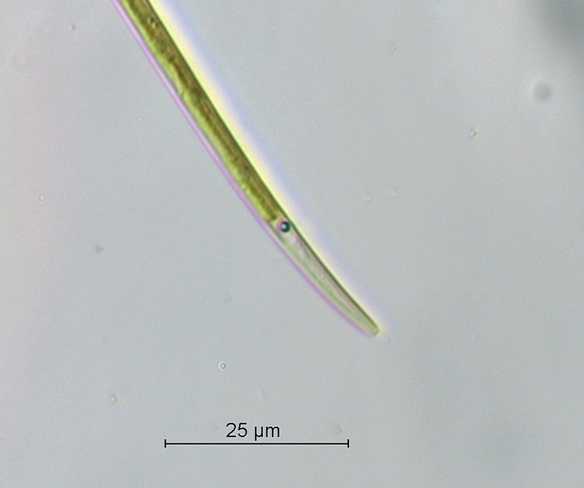 Closterium cf.limneticum_2.jpg
