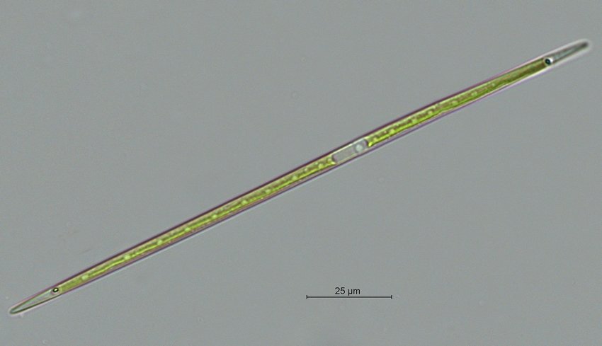 Closterium cf.limneticum_3.jpg