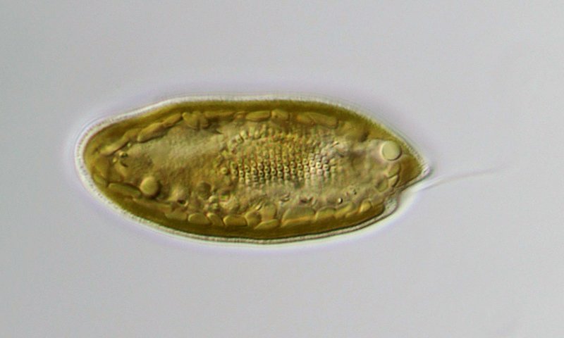 Auf diesem Bild sind besonders gut die Ejektisomen zu sehen. Das sind die kleinen runden Strukturen mit dem Loch in der Mitte.