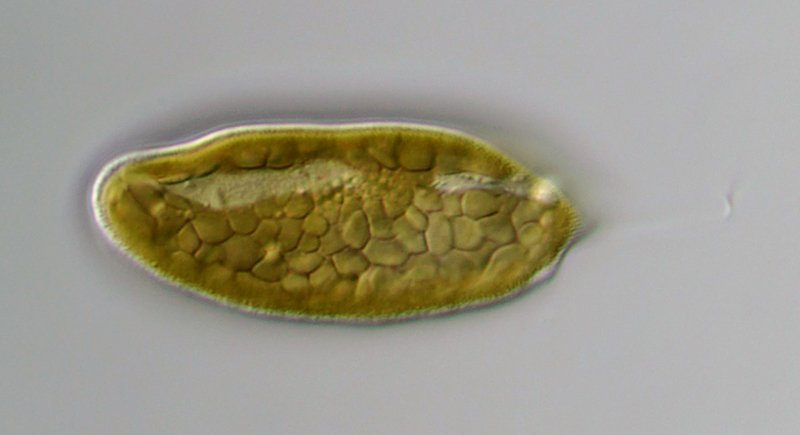 Hier habe ich auf Stärkekörner fokussiert, zumindest interpretiere ich das so. Oder es sind Teile der Chloroplasten.