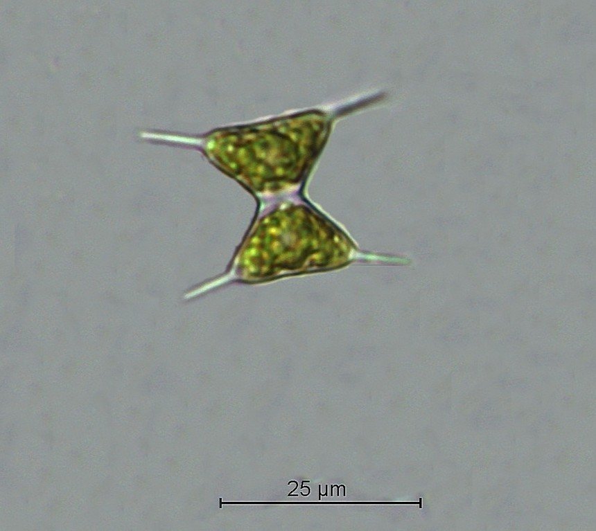 Staurodesmus triangularis_1.jpg