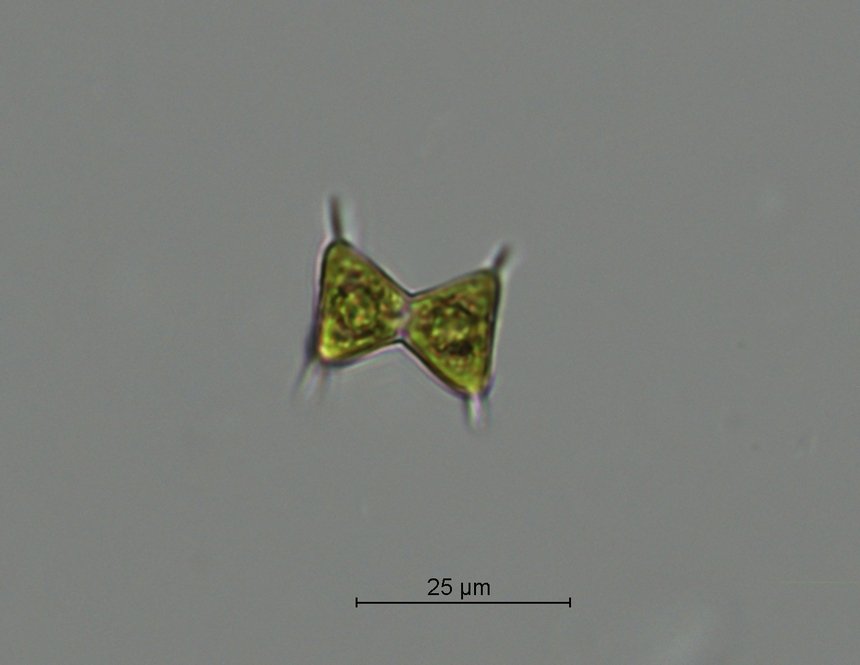 Staurodesmus triangularis _2.jpg