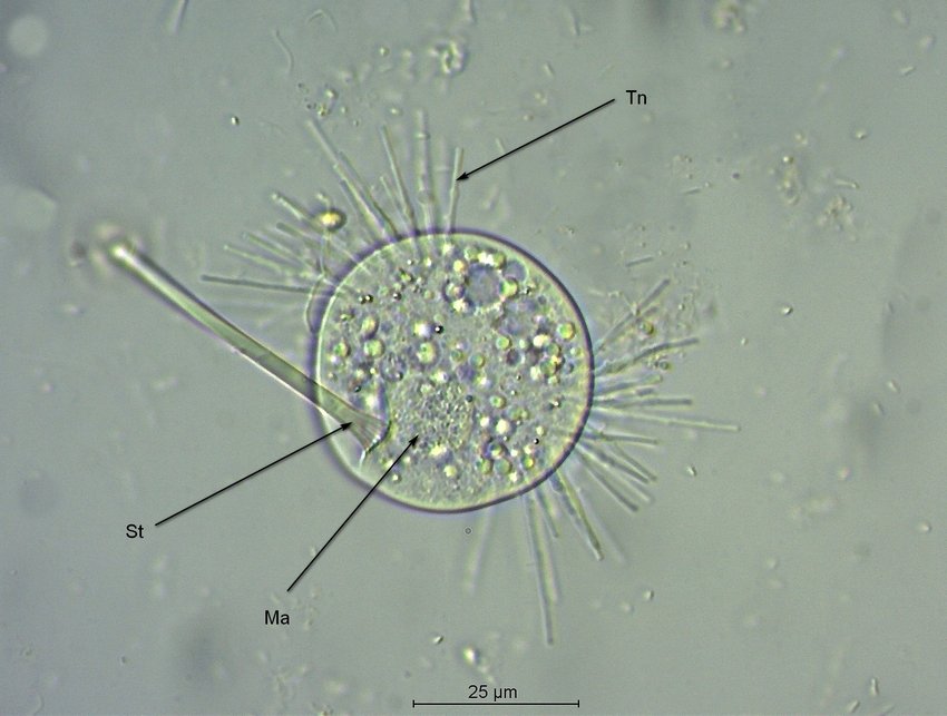 Tokophrya cf.infusionum.jpg