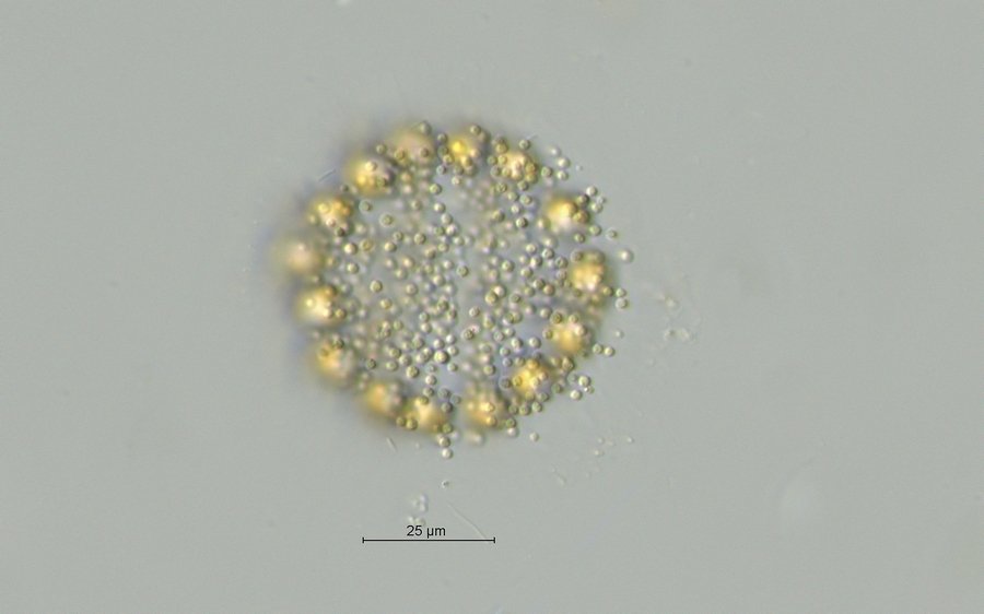 Chrysostephanosphaera globulifera_1.jpg