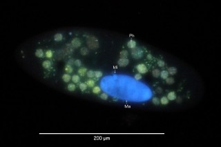 Bild 4: Fluoreszenzaufnahme des Zellkerns mit Macronucleus (Ma) und Micronucleus (Mi) und Phagosom (Ph). Die Phagosome (Nahrungsvakuolen) zeigen hier vor allem gefärbte DNA gefressener Bakterien.