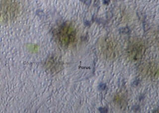 Bild 3: Bildausschnitt mit dem typischen Austrittsporus der kontraktilen Vakuole. Der Porus ist umgeben von vielen Trichocysten, die das Pantoffeltier zu einem bewaffneten und sehr wehrhaften Ciliaten machen.