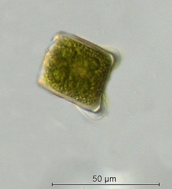 Cylindrocystis brebissonii_Zygote.jpg