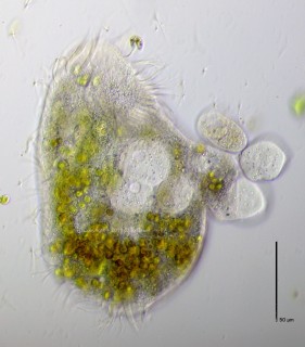 Hypotricher-mit-Parasiten.jpg