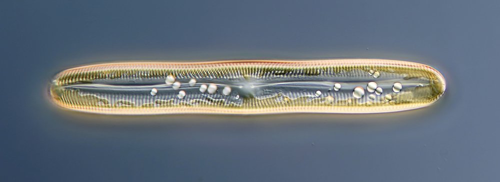 EM Pinnularia 01-1000.jpg