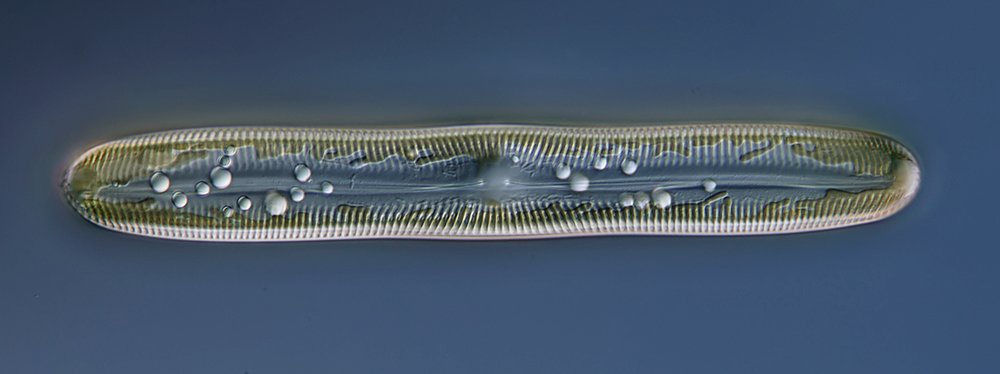 EM Pinnularia 04-1000.jpg