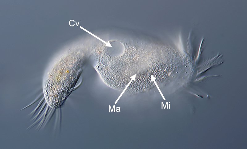 D Oxytrichidae 02B - 150 µm.jpg