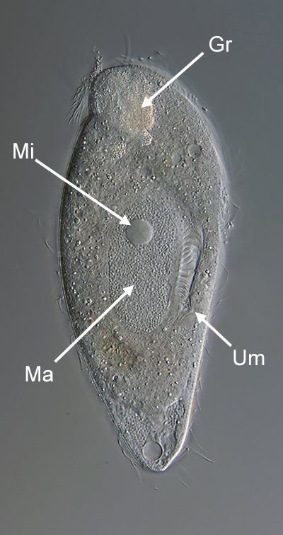 GT Metopus es 02- 175µm- 400.jpg