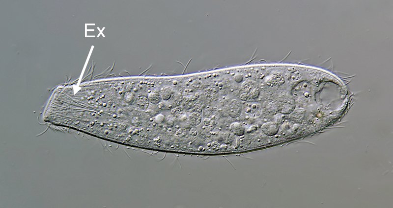 MT 800 Spathidium muscicola 09 - 125 µm.jpg