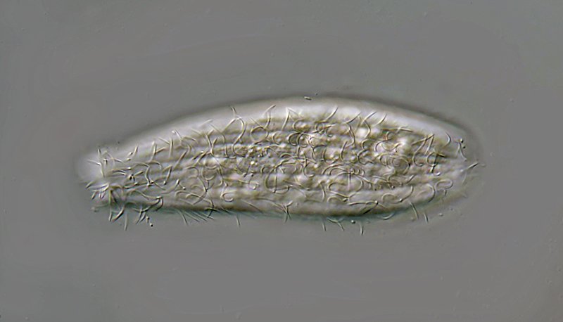 MT 800 Spathidium muscicola 02 - 125 µm.jpg