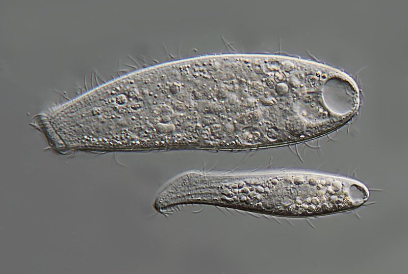 MT 800 Spathidium muscicola & S. sp. 01 - 125 + 88 µm.jpg
