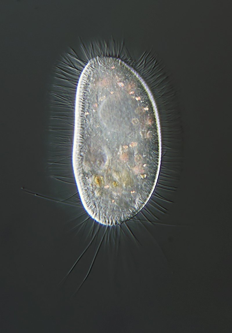 HWS Pleuronema coronatum 01 - 75 µm 800.jpg