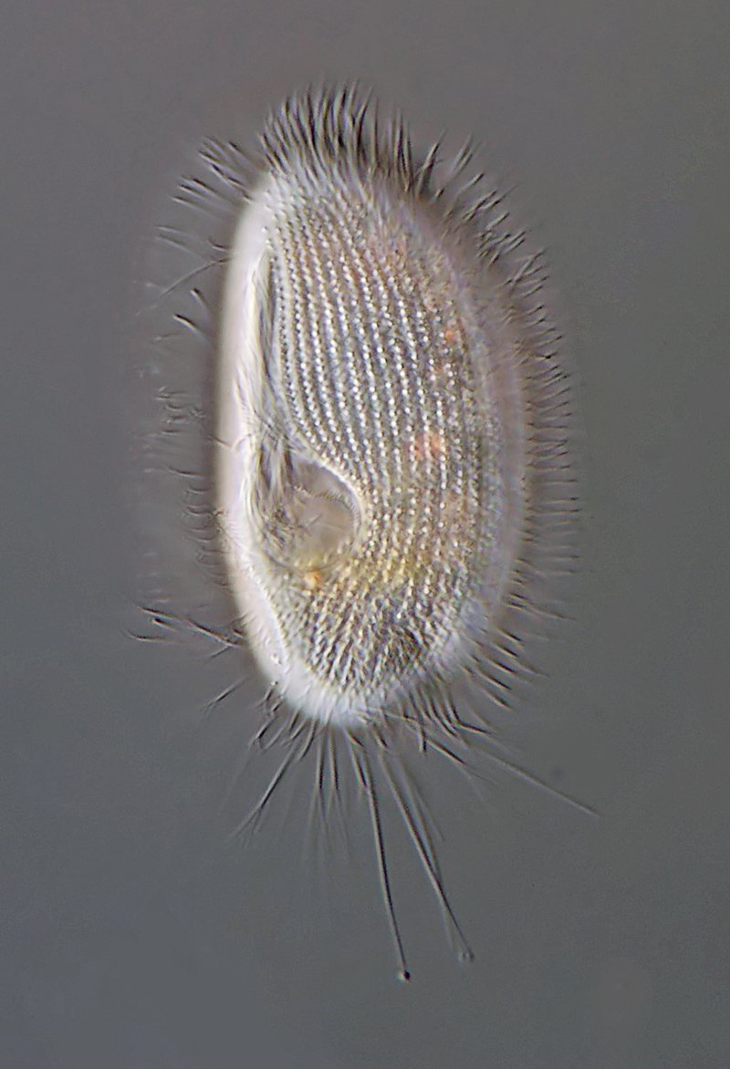 HWS Pleuronema coronatum 03 - 75 µm 800.jpg