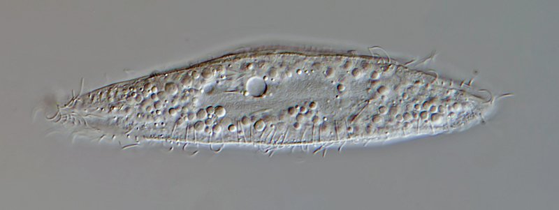 HWS Loxophyllum helus 02 - 125 µm 800.jpg
