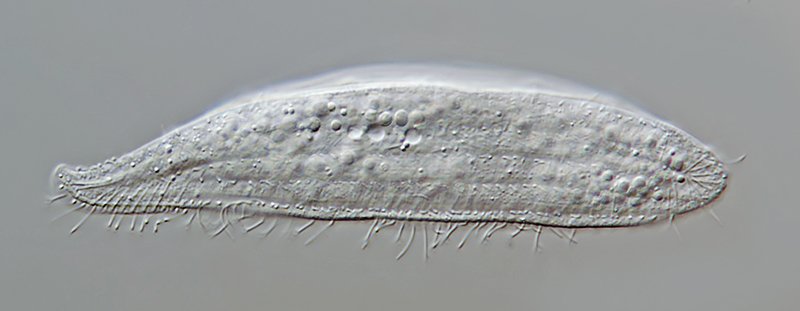 HWS Loxophyllum helus 03 - 125 µm 800.jpg